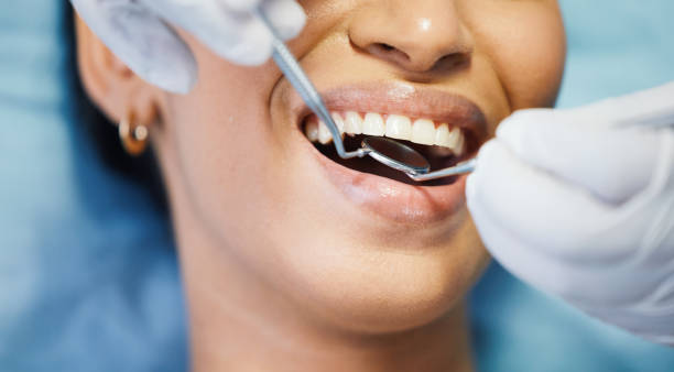 Best Dentist for Tooth Abscess  in Wlow Springs, IL